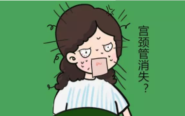 宫颈管消失是什么意思 宫颈管消失后多久分娩